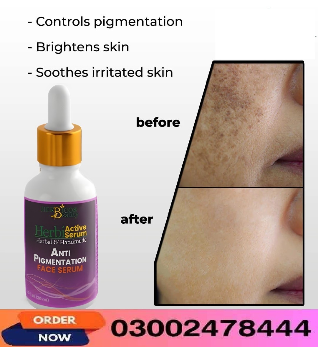 Anti Pigmentation Face Serum In Sheikhupura - 0300247