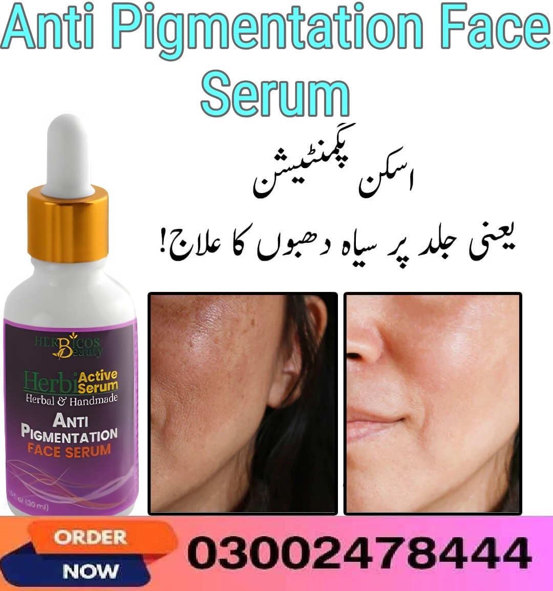 Anti Pigmentation Face Serum In Jhang - 0300247