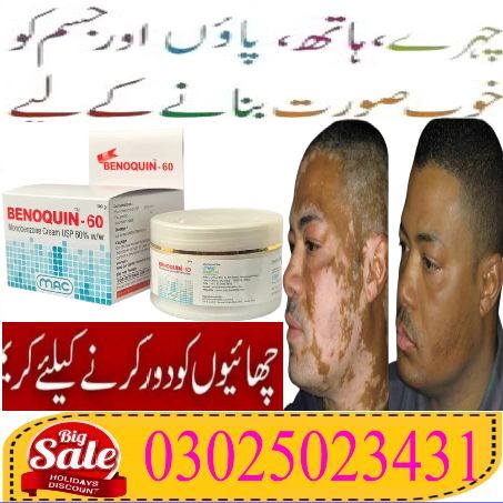 Benoquin Cream In Lahore ~ 03025023431 ~ Available now