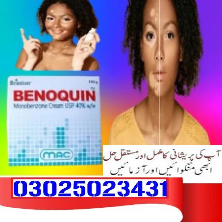 Benoquin Cream In Karachi ~ 03025023431 ~ Opentelesale
