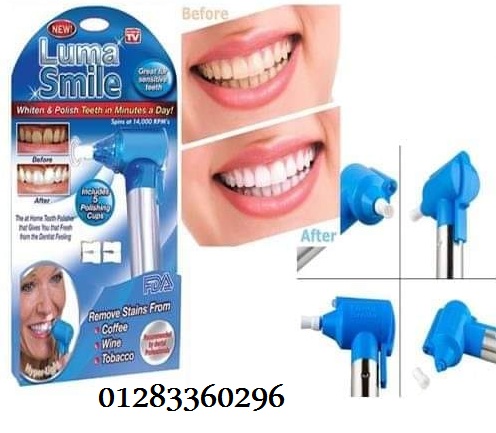 جهاز Luma Smile – تنظيف وتلميع الأسنان بشكل احترافي-ابتسامة ناصعة 