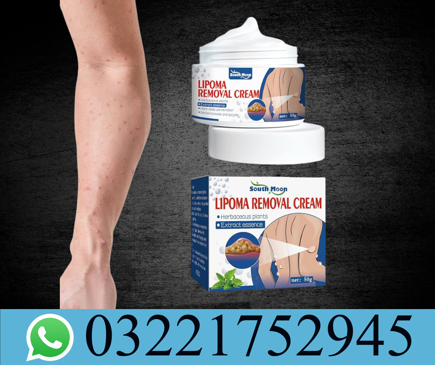 Lipoma Removal Cream Price in Pakistan – Best Lipoma Care Cream | Cash on Delivery