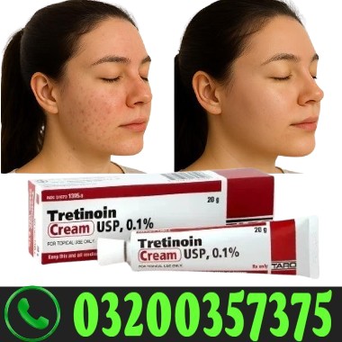 Tretinoin Cream 0.1% in Pakistan for Acne, Pimples & Skin Renewal