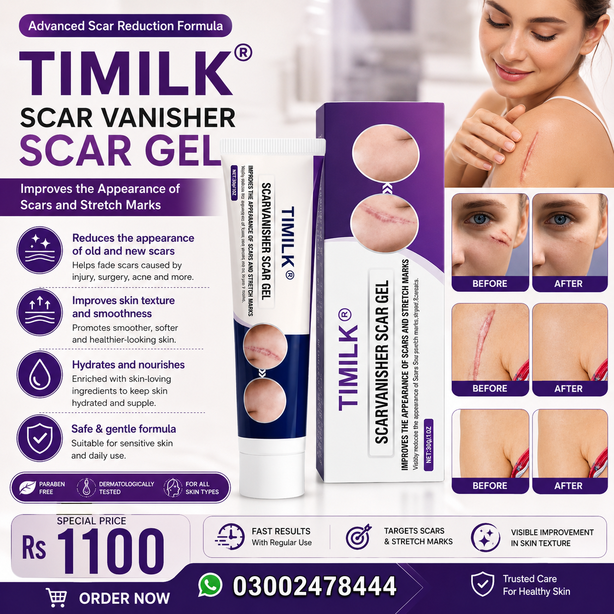 Timilk Scar 30g Gel in Pakistan Shop Now At EtsyHerbalShop