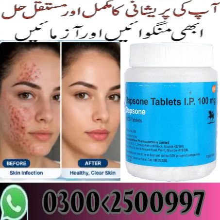 Dapsone 100mg Tablets In Karachi ( @@@@@@@@@@@@@ ) Orders