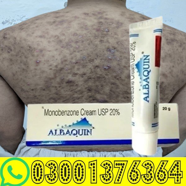 Monobenzyl Ether of Hydroquinone Cream Price in Karachi | Prescription Skin Cream
