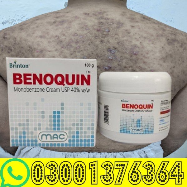 Benoquin Cream 60% Price in Faisalabad | Prescription Depigmenting Cream skin damage