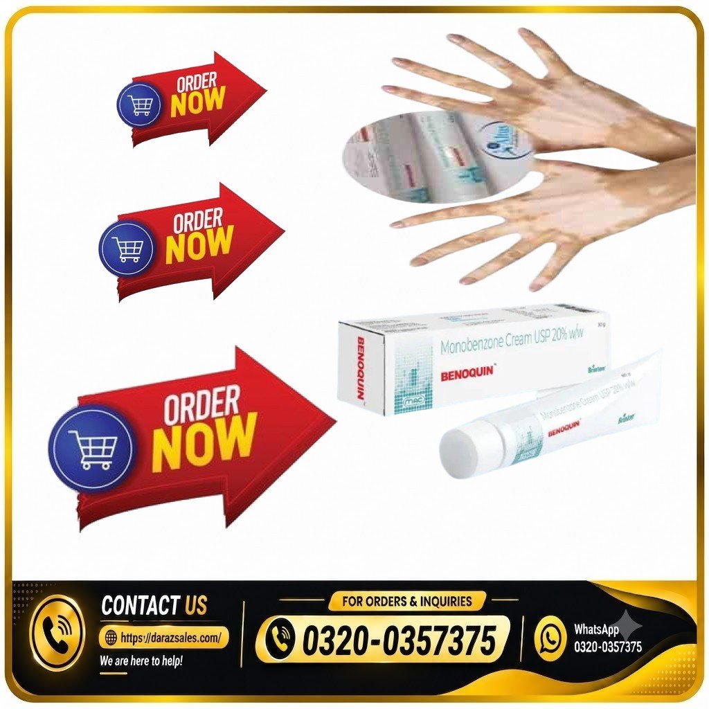 Benoquin Cream Price in Peshawar | Monobenzone Depigmenting Cream medical supervision.